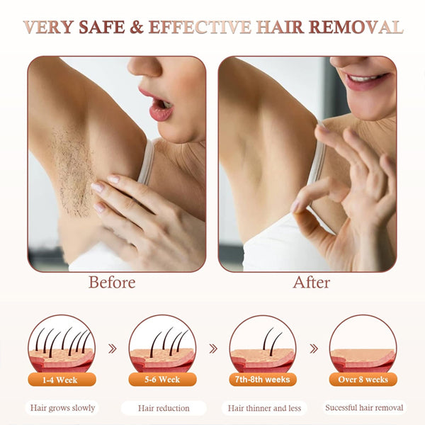 Laser Hair Removal for Women and Men, IPL Hair Removal with Ice Cold Function